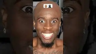 BALD N*GGA #bald #baldy #baldhead