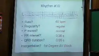 Chest disease pt (ECG part 3 & Lecture 10)
