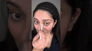 Full Face Botox Dosing