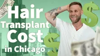 Hair Transplant Cost Chicago - How Much does a FUE Hair Transplant Cost in Chicago?
