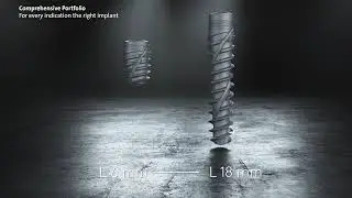 Straumann&reg; Pro Arch in combination with the new Straumann&reg; BLX implant Intro