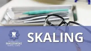 Maszewski Dental - Skaling