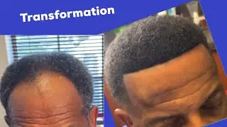 How to do man weave using human hair 😎🔥🔥