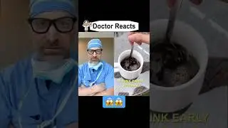 Doctor Suggestion!😱#shorts #workout