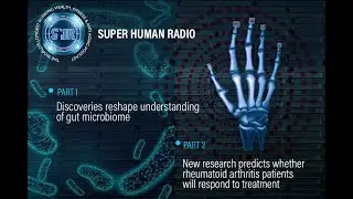 Discoveries Reshape Understanding of Microbiome + Research Predicts RA Patients Respond to Treatment