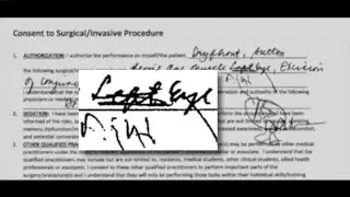 Lawsuit: Suburban doctor operated on wrong eye