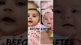 For homemade oil dm 9037633604#baby #cute