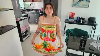Minhas pernas ap&oacute;s a queimadura ficaram assim