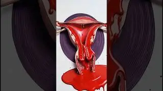 पीरियड नहीं था? 😳 | Implantation Bleeding vs Period सच&rdquo;#ImplantationBleeding #PeriodVsPregnancy