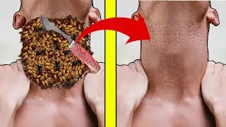 ASMR Man Neck Insects & worm Cleaning  | severely injured animation | Unmute asmr