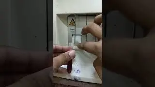 How to use medonic cell counter machine ...#shorts #short #youtubeshorts #shortvideo #viral