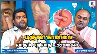 Don't ignore jaundice! Dr Senthil Kumar & Dr Dinesh Ramasamy Interview