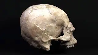 Skull from Jericho