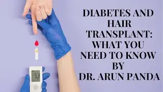 Diabetes and Hair Transplant: What You Need to Know before getting Hair Transplant
