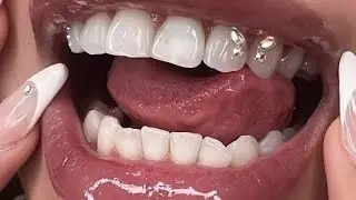 straight n white teeth affs