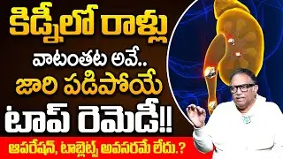 VRK Diet - Tips for Kidney Health | How to Reduce Kidney Stones | Water Technique | iDream