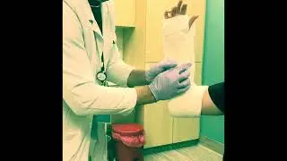 Johanning Sugar Tong Splint