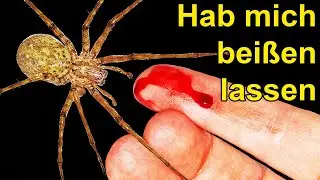 Was passiert wenn Dich die gr&ouml;&szlig;te Spinne Deutschlands bei&szlig;t? (Selbst-Test)