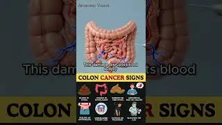 Silent Warning Signs of Colon Cancer You Need to Know