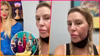 &lsquo;Misery&rsquo; Brandi Glanville blames Bravo for severe facial swelling: &lsquo;Stress will kill
