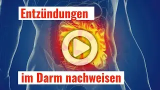 Entz&uuml;ndungen im Darm nachweisen mit einem einfachen Stuhltest