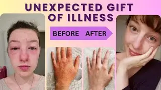 The Unexpected Gift of Illness &mdash; A Journey of Healing & Self-Discovery with M&eacute;lodie 🌿✨🇯🇵日本語の字幕あり