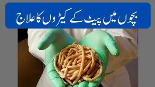 How to Treat Abdominal Worms in Children | Symptoms, Home Remedies & Medications