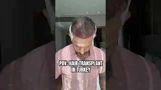 Let&rsquo;s go to turkey to get a hair transplant.