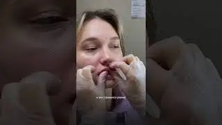 Как правильно делать массаж после увеличения губ?🤔 #увеличениегуб #косметолог #красноярск