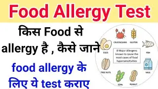 किस food से allergy है कैसे जाने || Food allergy test - Lactose , MSG , Gluten