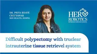 Difficult polypectomy with truclear intrauterine tissue retrievel system