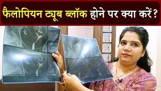 How to Open Blocked Fallopian Tube? | Fallopian Tube Blockage Treatment - Aasha Ayurveda