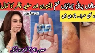 Alum Magic To Get Rid Of Wrinkles | Alum (Phitakri) For Skin Tightening| Minimize Open Pores