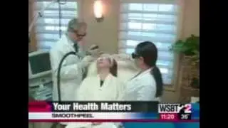 Smoothpeel Laser Facial in NJ