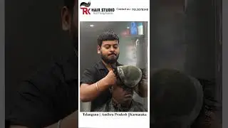 Top Non-Surgical Hair Patch in Bangalore!