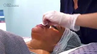 Superficial skin peel with no downtime