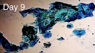 Female Dog Cytology Of Heat Cycle