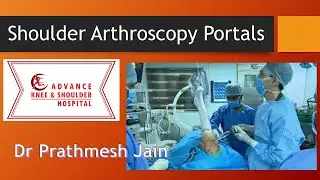 Shoulder arthroscopy Position and Portals for Training of Orthopedic Surgeons