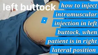 How to inject intramuscular injection in left buttock when patient is in right lateral position