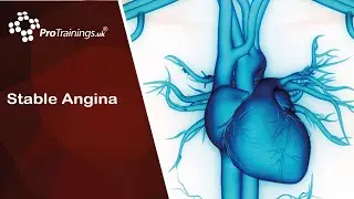 Stable Angina