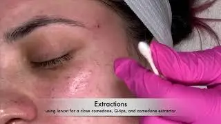 Super Hydrating Facial Treatment on Desiree
