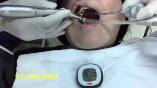 SybronEndo