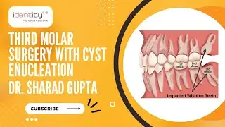 Third Molar Surgery with Cyst Enucleation | Identity+