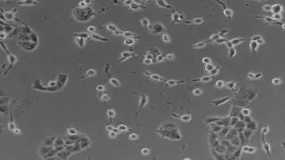 LnCAP y M220 diana PSMA, LnCAP