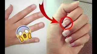 FAIRE POUSSER SES ONGLE 2× PLUS VITE ! ÇA MARCHE !!