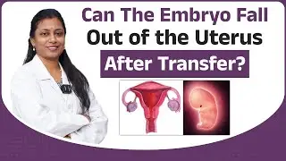 Can the Embryo Fall Out of the Uterus After Transfer? || Dr.Neeraja
