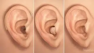 Ear, Nose, And Throat Videos Anatomy.