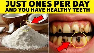 ELDERIES Eat This Products And Protect Your Teeth From Caries 