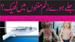 Skin Gun Fix the Burn Wounds 200X Faster Technology of the future Urdu News Universal Datcom.