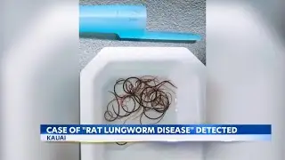Health alert in Kauai after new rat lungworm disease case